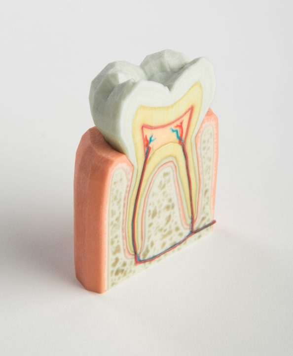 Modelo de diente 3D